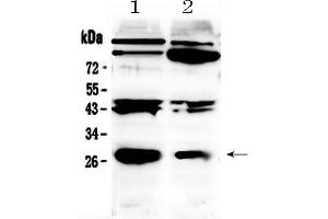 Western blot analysis of PDGF beta using anti- PDGF beta antibody . (PDGFB anticorps  (C-Term))