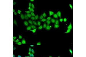 Immunofluorescence analysis of A549 cells using HSPA14 Polyclonal Antibody (HSPA14 anticorps)