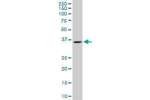 SH3GL2 monoclonal antibody (M06), clone 2G6. (SH3G2 anticorps  (AA 64-124))