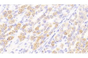 anti-Regenerating Islet-Derived 3 alpha (REG3A) (AA 40-164) antibody