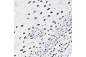 Immunohistochemistry of paraffin-embedded human esophageal using Histone H1t Rabbit pAb (ABIN7267716) at dilution of 1:100 (40x lens).