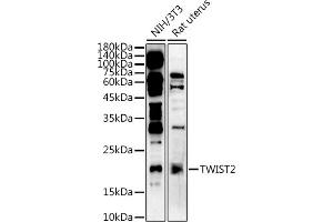 Western blot analysis of extracts of various cell lines, using  at 1:500 dilution. (TWIST2 anticorps  (AA 1-70))