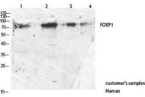 Western Blotting (WB) image for anti-Forkhead Box P1 (FOXP1) (C-Term) antibody (ABIN3178244) (FOXP1 anticorps  (C-Term))