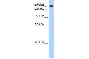 SCN5A antibody used at 0. (SCN5A anticorps  (C-Term))