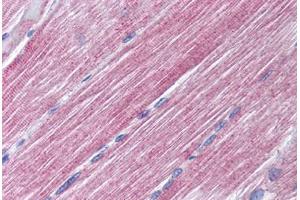 Human Skeletal Muscle (formalin-fixed, paraffin-embedded) stained with RAB7A antibody ABIN299824 at 10 ug/ml followed by biotinylated goat anti-rabbit IgG secondary antibody ABIN481713, alkaline phosphatase-streptavidin and chromogen. (RAB7A anticorps  (AA 90-140))