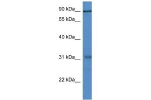 WB Suggested Anti-Mid2 Antibody   Titration: 1. (Midline 2 anticorps  (N-Term))