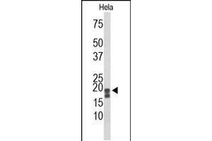 Western blot analysis of ACP1 Antibody in Hela cell line lysates (35ug/lane)