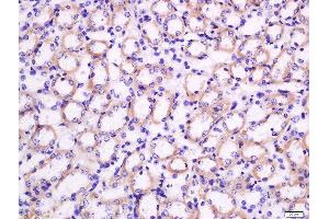 Formalin-fixed and paraffin embedded mouse kidney tissue labeled with Rabbit Anti-Nocturnin Polyclonal Antibody, Unconjugated  at 1:200 followed by conjugation to the secondary antibody and DAB staining (CCRN4L anticorps  (AA 231-330))