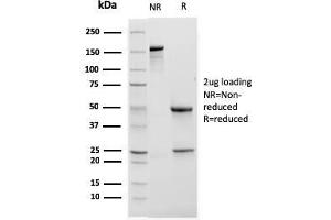 SDS-PAGE Analysis Purified CD11b Monospecific Mouse Monoclonal Antibody (ITGAM/3338).