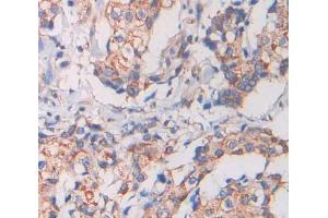 IHC-P analysis of Kidney tissue, with DAB staining. (KEL anticorps  (AA 128-332))