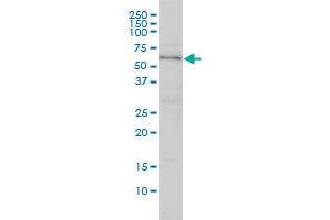DNAJC7 monoclonal antibody (M01), clone 4G6-G3 Western Blot analysis of DNAJC7 expression in Hela .