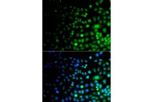 Immunofluorescence analysis of A549 cells using UBA6 antibody (ABIN5975585). (UBA6 anticorps)
