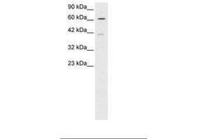 Image no. 2 for anti-SNW Domain Containing 1 (SNW1) (AA 103-152) antibody (ABIN6735801)