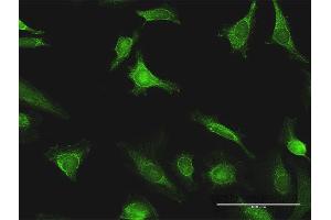 Immunofluorescence of purified MaxPab antibody to EXT1 on HeLa cell. (EXT1 anticorps  (AA 1-746))