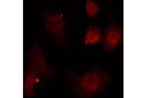 ABIN6274698 staining HeLa cells by IF/ICC. (PMS2 anticorps  (C-Term))