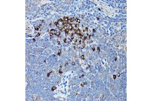 Immunohistochemistry of paraffin-embedded mouse spleen using DDIT3/CHOP Rabbit pAb (ABIN6131562, ABIN6139460, ABIN6139463 and ABIN6215170) at dilution of 1:200 (40x lens). (DDIT3 anticorps  (AA 1-169))