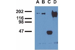 Immunoprecipitation ofEGFR from EGF-treated A431 cells byphosphospecific monoclonal antibodies (A), EM-13 (B), a commercial anti-EGFR polyclonal antibody(C) and anti-EGFR monoclonal mAb108 (D).
