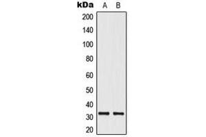 Western blot analysis of ELOVL1 expression in HeLa (A), HepG2 (B) whole cell lysates. (ELOVL1 anticorps  (Center))
