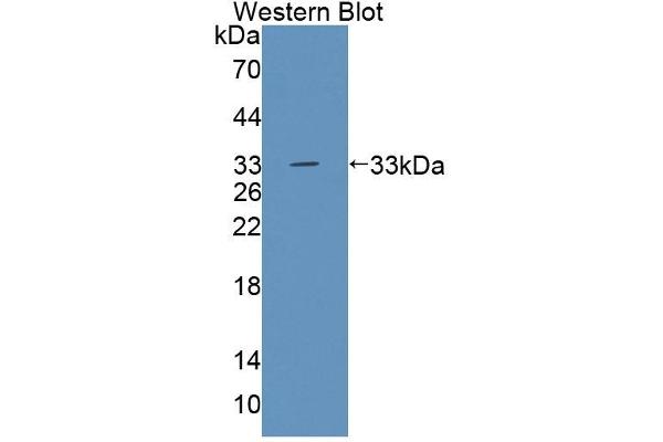 Tec Protein Tyrosine Kinase (TEC) (AA 369-622) antibody