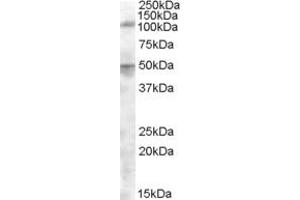 Western Blotting (WB) image for anti-Endoplasmic Reticulum Aminopeptidase 2 (ERAP2) (AA 480-493) antibody (ABIN343047) (ERAP2 anticorps  (AA 480-493))