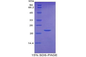SDS-PAGE (SDS) image for Colony Stimulating Factor 3 Receptor (Granulocyte) (CSF3R) (AA 655-837) protein (His tag) (ABIN2120867)