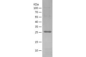 Western Blotting (WB) image for RAB9A, Member RAS Oncogene Family (RAB9A) (AA 2-201) protein (His tag) (ABIN7124766)
