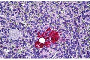 Human Spleen, Macrophages: Formalin-Fixed, Paraffin-Embedded (FFPE) (Galectin 3 anticorps  (AA 141-190))
