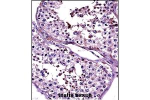 CTAG2 Antibody (Center) ((ABIN657689 and ABIN2846680))immunohistochemistry analysis in formalin fixed and paraffin embedded human testis tissue followed by peroxidase conjugation of the secondary antibody and DAB staining.