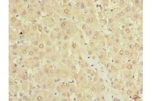 Immunohistochemistry of paraffin-embedded human liver tissue using ABIN7173011 at dilution of 1:100 (TMPRSS6 anticorps  (AA 98-301))