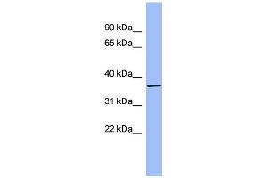 WB Suggested Anti-HAPLN1 Antibody Titration:  0. (HAPLN1 anticorps  (N-Term))