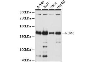 Western blot analysis of extracts of various cell lines, using RBM6 antibody (ABIN6129739, ABIN6146788, ABIN6146789 and ABIN6214632) at 1:2000 dilution. (RBM6 anticorps  (AA 530-770))
