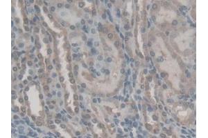 IHC-P analysis of Rat Kidney Tissue, with DAB staining. (Retinol Binding Protein 5 anticorps  (AA 19-201))