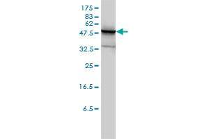 PHGDH monoclonal antibody (M01), clone 4A3-1D6 Western Blot analysis of PHGDH expression in Jurkat .