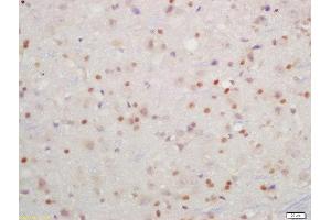 Formalin-fixed and paraffin embedded rat brain labeled with Rabbit Anti-IKK beta(Tyr199) Polyclonal Antibody, Unconjugated  at 1:200 followed by conjugation to the secondary antibody and DAB staining (IKBKB anticorps  (pTyr199))