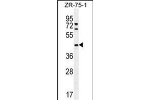 METTL2 Antibody (C-term) (ABIN655892 and ABIN2845293) western blot analysis in ZR-75-1 cell line lysates (35 μg/lane). (METTL2 anticorps  (C-Term))