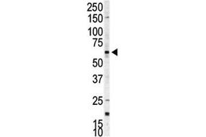 Western blot analysis of p70 S6 Kinase beta antibody and A375 cell lysate.