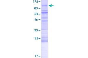 Image no. 1 for Methyl-CpG Binding Domain Protein 4 (MBD4) (AA 1-574) protein (GST tag) (ABIN1310473)