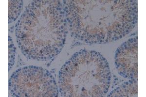 IHC-P analysis of Mouse Testis Tissue, with DAB staining. (CX3CL1 anticorps  (AA 83-330))
