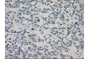 Image no. 3 for anti-Crystallin, alpha B (CRYAB) antibody (ABIN1497645) (CRYAB anticorps)