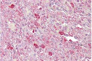 Immunohistochemistry with Spleen tissue at an antibody concentration of 5µg/ml using anti-ATF1 antibody (ARP38574_P050) (AFT1 anticorps  (C-Term))