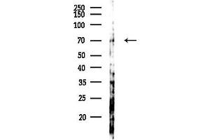 anti-PR Domain Containing 5 (PRDM5) antibody