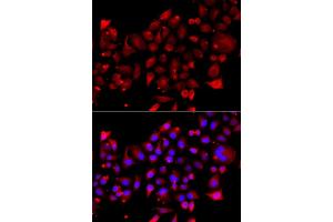 Immunofluorescence analysis of A549 cell using RRM2B antibody.