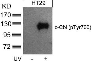 Western blot analysis of extracts from HT29 cells untreated or treated with UV using c-Cbl(phospho-Tyr700) Antibody.