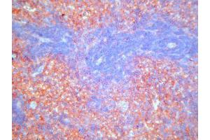 Immunohistochemistry (IHC) image for anti-Complement Component (3b/4b) Receptor 1-Like (CR1L) antibody (ABIN781721) (CR1L anticorps)