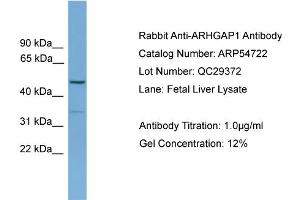 WB Suggested Anti-ARHGAP1  Antibody Titration: 0. (ARHGAP1 anticorps  (N-Term))