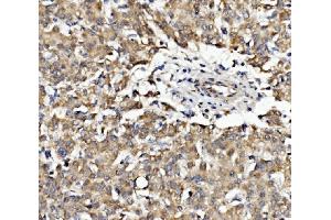 IHC analysis of EPB41L5 using anti-EPB41L5 antibody (ABIN7601550). (EPB41L5 anticorps  (AA 38-733))