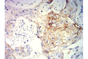 Immunohistochemical analysis of paraffin-embedded brain tissues using GZMB mouse mAb with DAB staining.