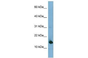 MED31 antibody used at 1 ug/ml to detect target protein. (MED31 anticorps  (N-Term))