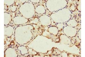 Immunohistochemistry of paraffin-embedded human thyroid tissue using ABIN7165806 at dilution of 1:100 (MEMO1 anticorps  (AA 1-297))