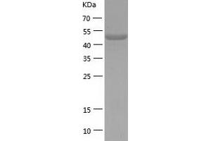 Enolase 2 (Gamma, Neuronal) (ENO2) (AA 1-434) protein (His-IF2DI Tag)
